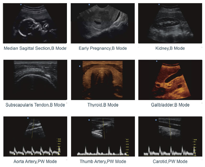 ENDO USG, Ultrasound Diagnostic System EI.USGBW