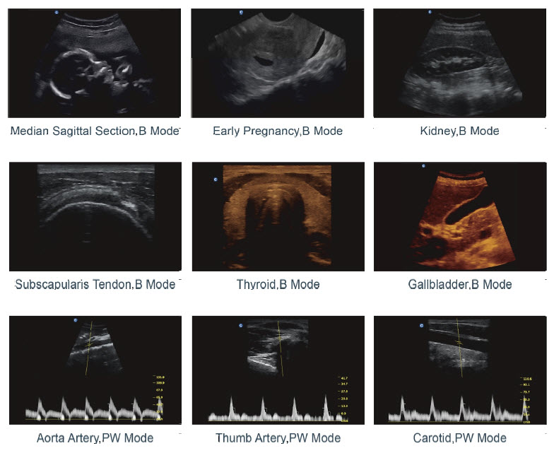 ENDO USG, Ultrasound Diagnostic System EI.USGBW