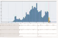 ENDO ECG Holter Monitoring EI.HM