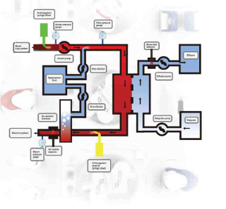 ENDO Hemodialysis Machine HDF-2